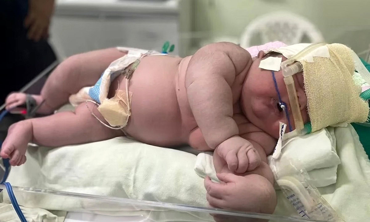 نوزاد ۷ کیلویی یکی از سنگین وزن‌ترین نوزادان جهان لقب گرفت + عکس